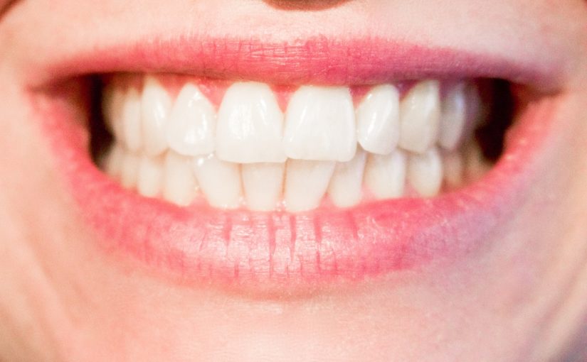 Dzisiejsza technologia stosowana w salonach stomatologii estetycznej zdoła sprawić, że odbierzemy ładny uśmiech.